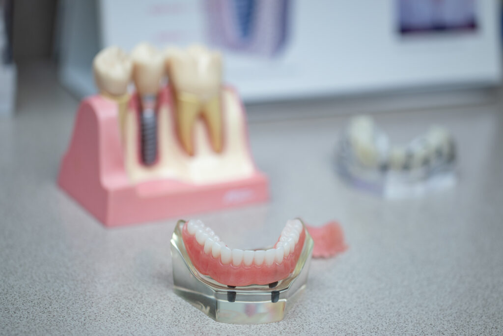 An example of a denture and dental implant
